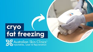 CryoDefine Fat Freezing  Australian Skin Clinics [upl. by Anile]