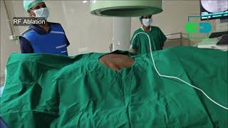 Trigeminal neuralgia treatment radio frequency ablation in ahmedabad gujrat [upl. by Man]