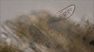 Paramecium caudatum under the microscope [upl. by Giuliana]