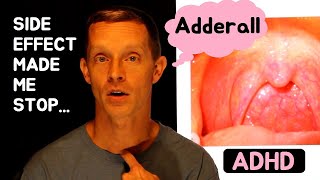 Side Effect of Adderall Made Me Stop  Dry Mouth amp Sore Throat  ADHD [upl. by Rosamund749]