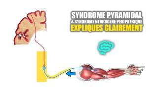 🔴 Syndrome pyramidal VS syndrome neurogène peripherique Expliqués Très Clairement par Dr Astuce [upl. by Carine790]