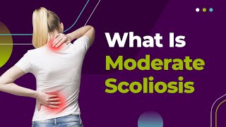 What Is Moderate Scoliosis [upl. by Gentilis149]