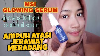 REVIEW PRODUK MSI  PENGGANTI MSI FRUIT SERUM YAITU MSI GLOWING SERUM  SERUM TERBAIK TERAMPUH [upl. by Mariko]