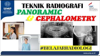 BELAJAR RADIOLOGI 10  PANORAMIC DAN CEPHALOMETRY radiologi radiografer [upl. by Procora]