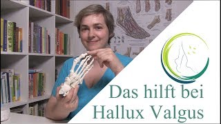 Das hilft bei Hallux Valgus podologinandrea [upl. by Sang710]