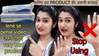 Eukroma Plus Cream Review  eukroma cream  eukroma plus cream uses in hindi 😱 [upl. by Lot]