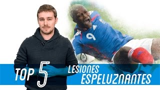 Las 5 Peores lesiones de la historia del fútbol [upl. by Agatha]