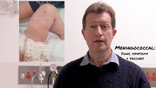 Meningococcal Disease Signs Symptoms and Vaccines [upl. by Ryter]