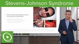 StevensJohnson Syndrome – Dermatology  Lecturio [upl. by Angadreme901]