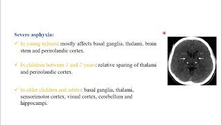 Drowning part 4 Imaging Modalities pediatriccriticalcaredraly8688 [upl. by Noivad]