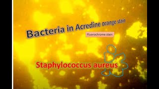 Staphylococcus aureus under Fluorescence microscopy [upl. by Aniri989]