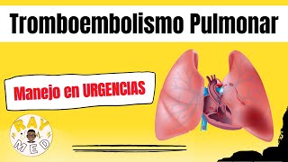 🚑TROMBOEMBOLISMO PULMONAR Parte 2 Abordaje Clínico y tratamiento [upl. by Knoll]