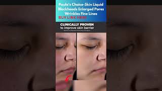 BUY LINK HERE I Spent 30 Days with Paulas Choice 2 BHA Liquid and My Skin is FLAWLESS [upl. by Ateinotna]