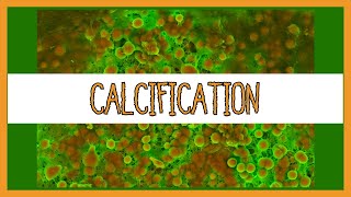 Dystrophic vs Metastatic Calcification [upl. by Atinit184]