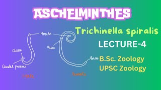 Aschelminthes  Trichinella spiralis Parasitic helminthes  Zoology  Notes in Description [upl. by Edyaj]