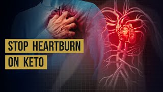 How to Stop Heartburn and Acid Reflux on Keto  Smart Diabetics Academy [upl. by Sheng]