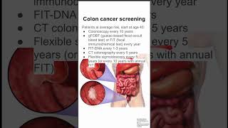 Colon cancer screening [upl. by Annayat]