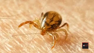 How a tick bite can lead to a dangerous allergy to red meat [upl. by Aniaj]