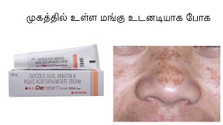 Demelan cream Review in Tamil  Mangu முகத்தில் உள்ள மங்கு உடனடியாக போக [upl. by Simsar]