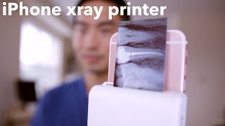 iPHONE XRAY PRINTER for DENTISTS [upl. by Craner696]