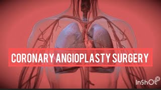 Angioplasty Procedure Animation Video  coronary angioplasty surgery  angioplasty surgery [upl. by Pena]