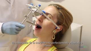 Articulador 12000 Plus Dentflex Registro con arco facial y montaje [upl. by Ettari]