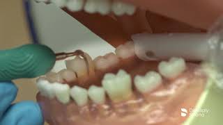 Cavitron FSI slimLine Right and Left  Curve  Dentsply Sirona [upl. by Denby]