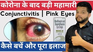 Conjunctivitis quotआँख आ जानाquot Pink Eyes Cause Symptoms amp Treatment [upl. by Arries]