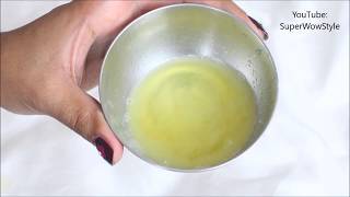 Get Rid of dandruff in 1 Day  Instant Dandruff Remedy at Home [upl. by Lisbeth]