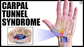 How Do I Know If I Have Carpal Tunnel Syndrome [upl. by Lauretta]