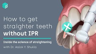 How to get straighter teeth without IPR  Inside the science of teeth straightening [upl. by Terryl]