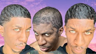 SIR CRUSE 360 Waves To 720 Waves  4 Weeks After The Scalp MAJOR PROGRESS 😱😱 [upl. by Meeharb]