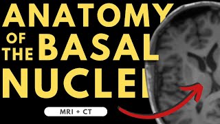 Basal ganglia basal nuclei neuroanatomy  Radiology anatomy part 1 prep  MRI  CT [upl. by Warfeld]