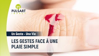 Les gestes de secours face à une plaie simple [upl. by Hsitirb]