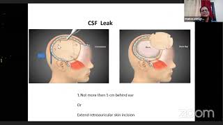 Decompressive Craniectomy  complications and avoidance [upl. by Nnyllaf]