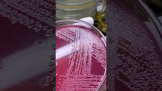 microbiology bacteria fungi chemistry microscopic microorganisms experiment parasites virus [upl. by Strage]