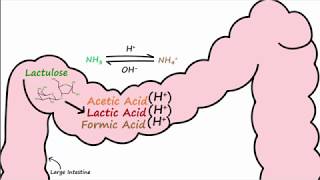 FALSE POSITIVES with Lactulose Breath Testing for SIBO [upl. by Allecsirp49]