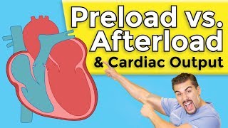 Cardiomyopathy  Preload vs Afterload [upl. by Nylazor255]