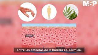 ¿Qué es la dermatitis atópica [upl. by Nessy]