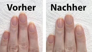 3 Tipps im Test um vergilbte Fingernägel aufzuhellen  seni Nageldesign [upl. by Hartmunn]