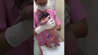 Neonatal early STEPPING Reflex [upl. by Adlanor]