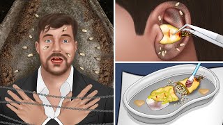 ASMR Remove queen termite from MrBeasts ear  Ear Cleaning Animation [upl. by Namlaz]