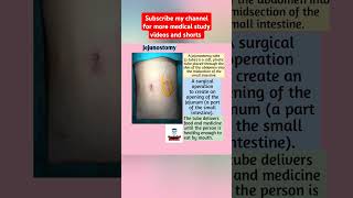 JejunostomyFreeMedicalEducationld3sfviralmedicalviralshortsvideoyoutubeviralshortsnursing [upl. by Eseerehc]