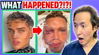 5 Plastic Surgeries on 1 Day That Went HORRIBLY Wrong [upl. by Semyaj]