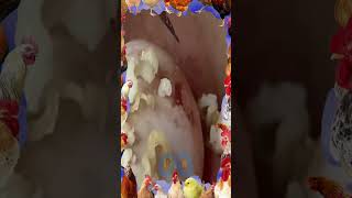 The Best Blackhead Video Removal 090 [upl. by Reginauld]