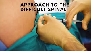 Approach to the difficult spinal [upl. by Madriene]