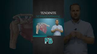 Tendinite Supraespinhal  Prof Felipe Barros shorts [upl. by Titania223]