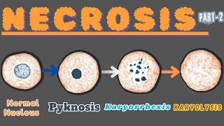 “Nuclear Metamorphosis Exploring Pyknosis Karyorrhexis and Karyolysis” Necrosis part 2 [upl. by Varian]