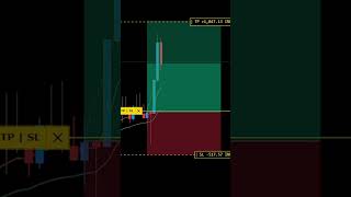 OPTIONS TRADING STRATEGY livetradeintraday trading shortsfeed [upl. by Yrahcaz329]