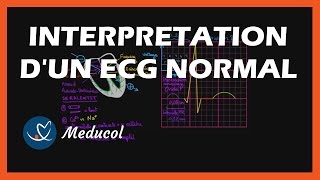 Electrocardiogramme ECG  interpretation dun ECG normal [upl. by Quinn766]